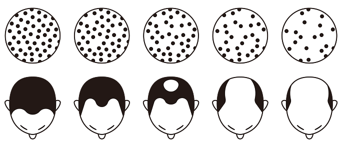 短期間で広範囲に進行するケース